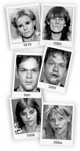The hideous look of crystal meth shows on the scarred and prematurely aged faces of those who abuse it. (Photo credit: courtesy Attorney General’s Office, Taswell County, Illinois) 